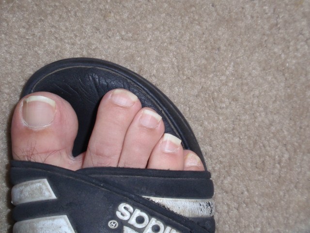 They smell even worse than they look.