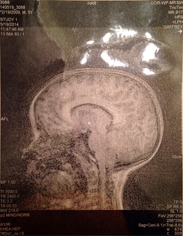 The MRI confirms that yes, Cool has a brain.